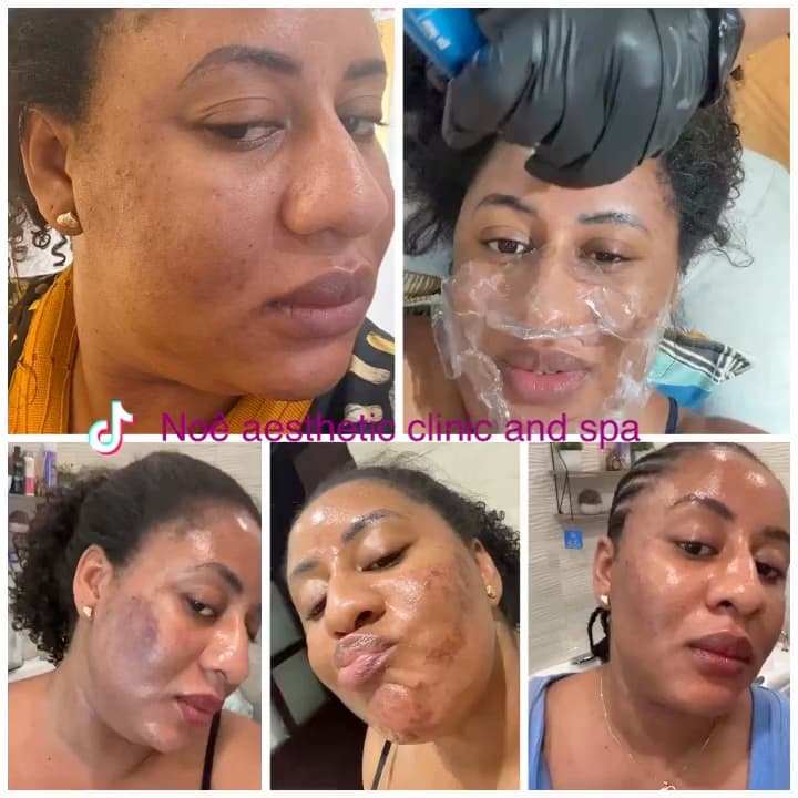 Advanced facials
