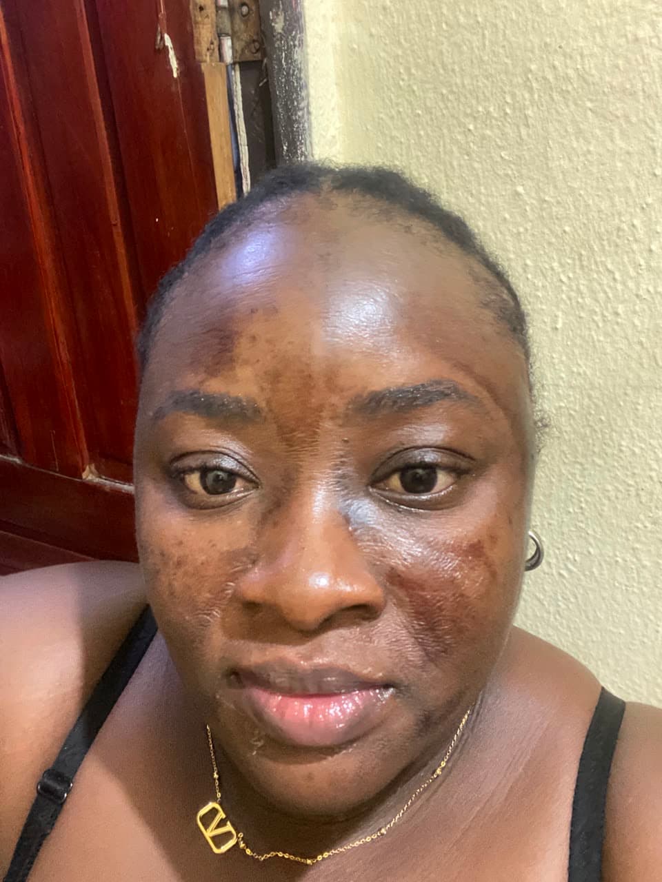 Advanced facials